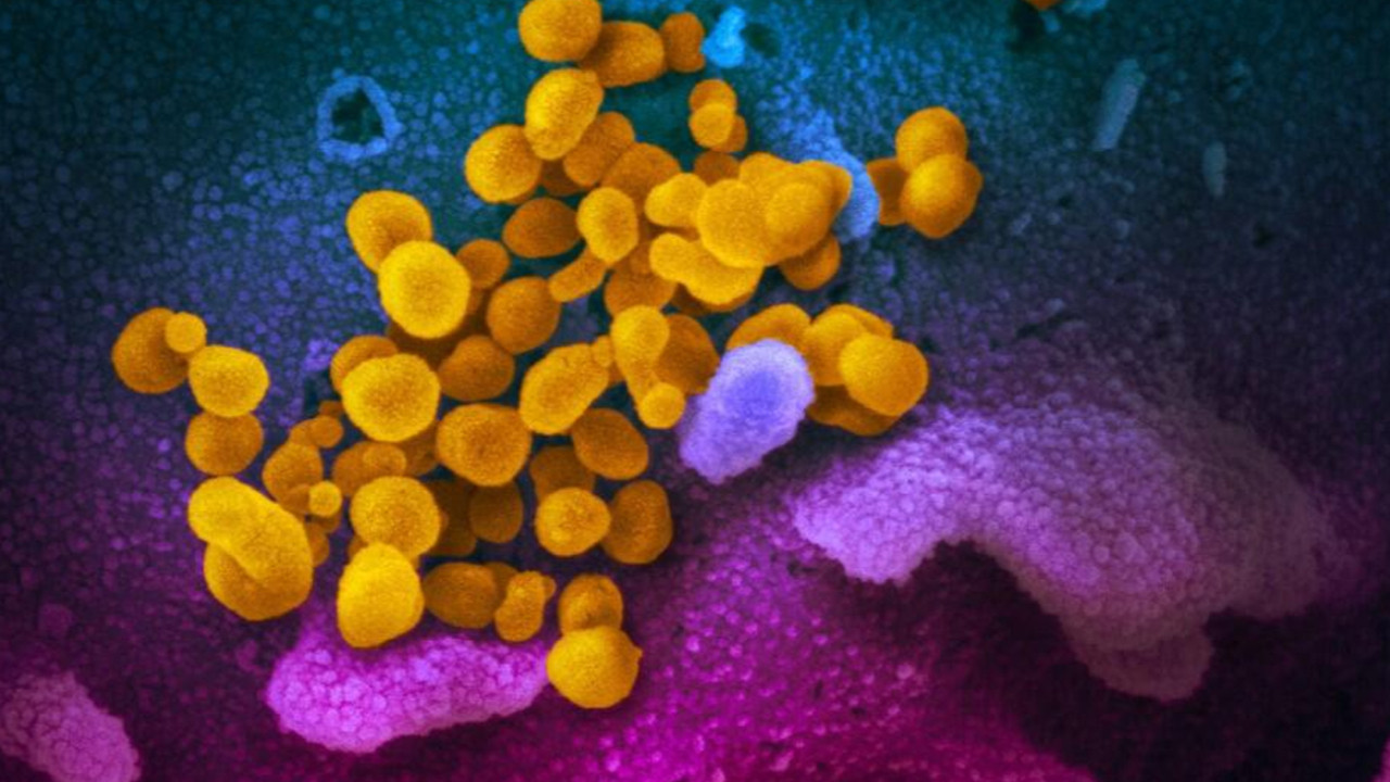 İzlanda'da bilim insanlarından 'koronavirüs' keşfi! 40 farklı mutasyon tespit edildi