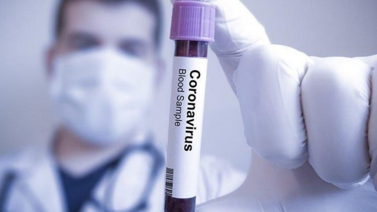 Türk bilim insanları koronavirüs tedavisinde kullanılan ilacı sentezledi