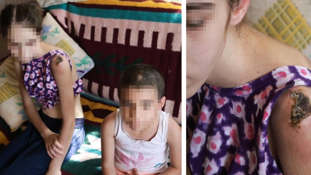Foça'da iki kardeşe keser sapıyla şiddet iddiasında üvey baba tutuklandı