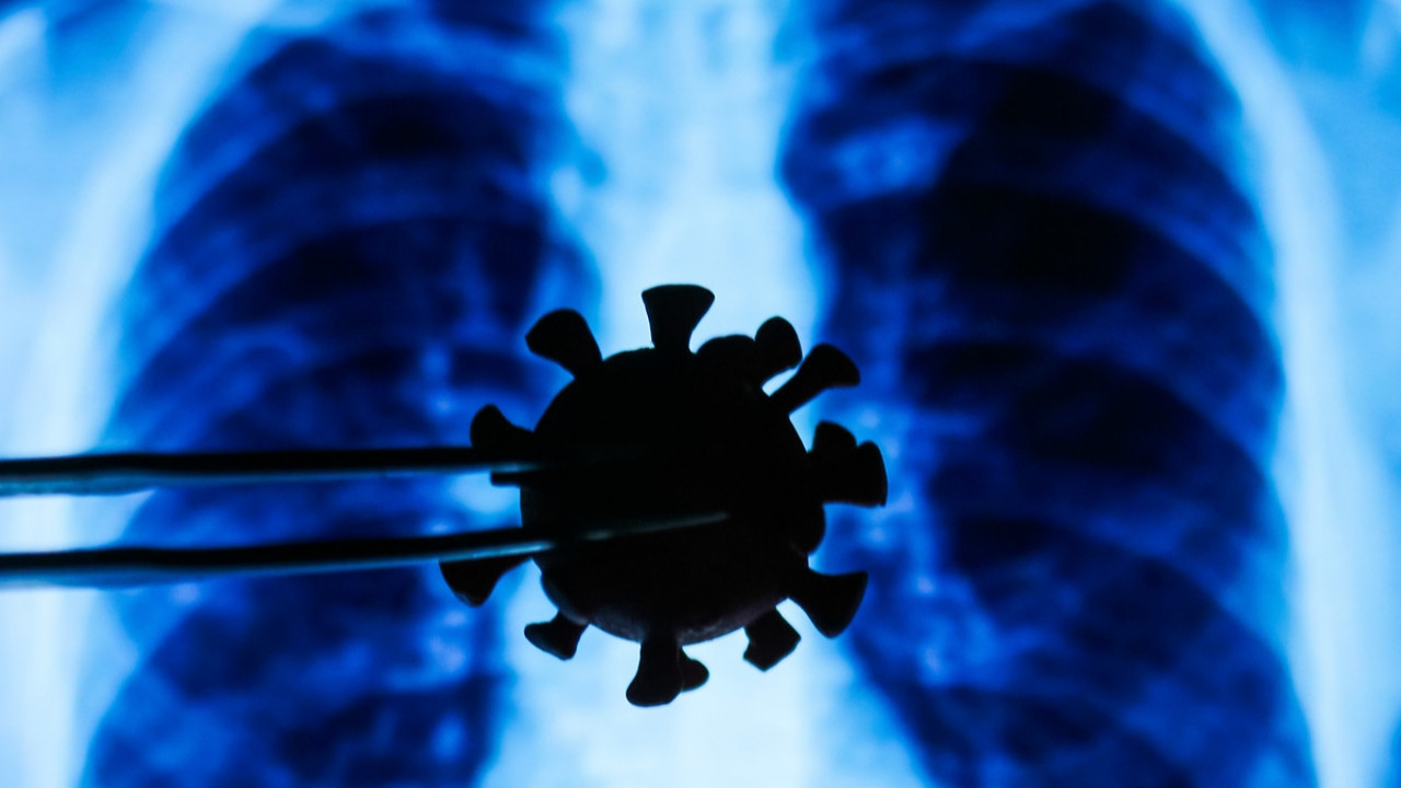 Dr. Sema Turan: Virüsün akciğer hasarı inanılmaz