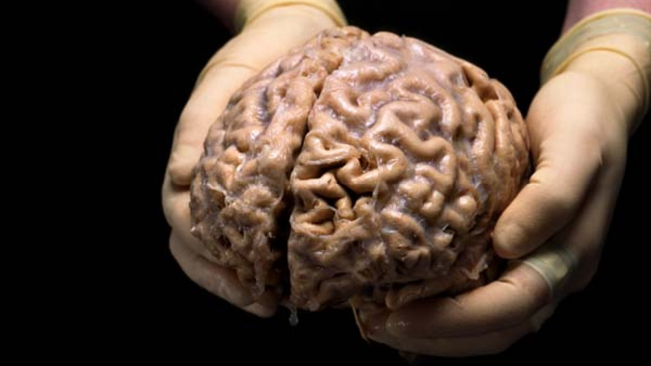 İnsan Beyninin 3D Haritası Oluşturuldu! Ortaya Öyle Bir Şey Çıktı Ki?