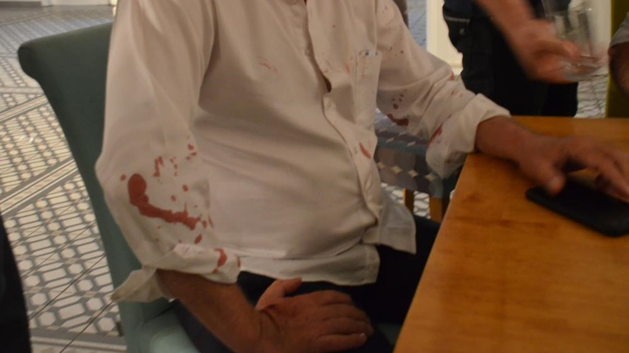 CHP'li belediye başkanına beyzbol sopalı saldırı!