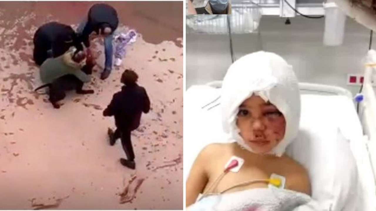 Pitbull saldırısında ağır yaralanan Asiye Ateş'in son fotoğrafı geldi! Hastaneden paylaştılar...