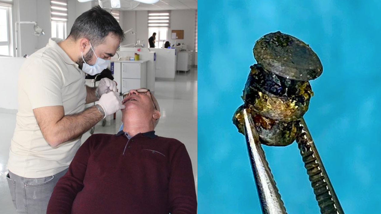 Dişçinin tuttuğu mıknatıs yüzünü çekince 15 yıllık gerçek ortaya çıktı