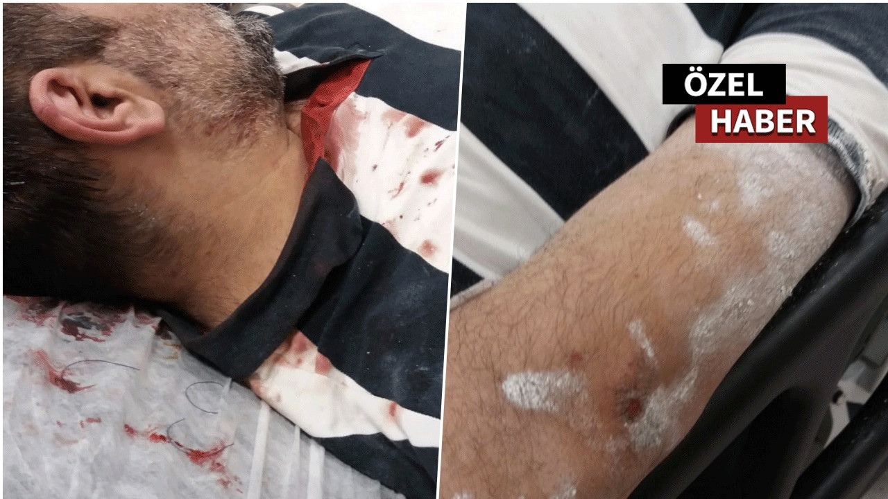 Büyükada'da gazeteci Güngör feci şekilde darp edildi! CHP'li Adalar Belediyesi haberleri ile gündem olmuştu