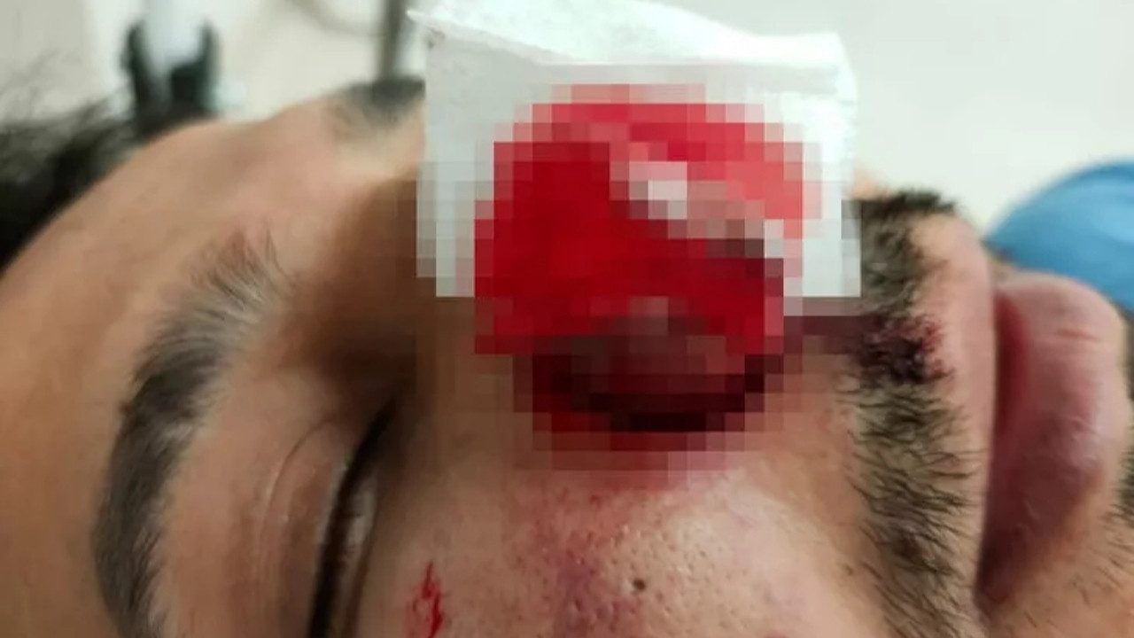 Bağcılar Eğitim Araştırma Hastanesi'nde sağlık çalışanına saldırı: Kanlar avuçlarıma doldu!