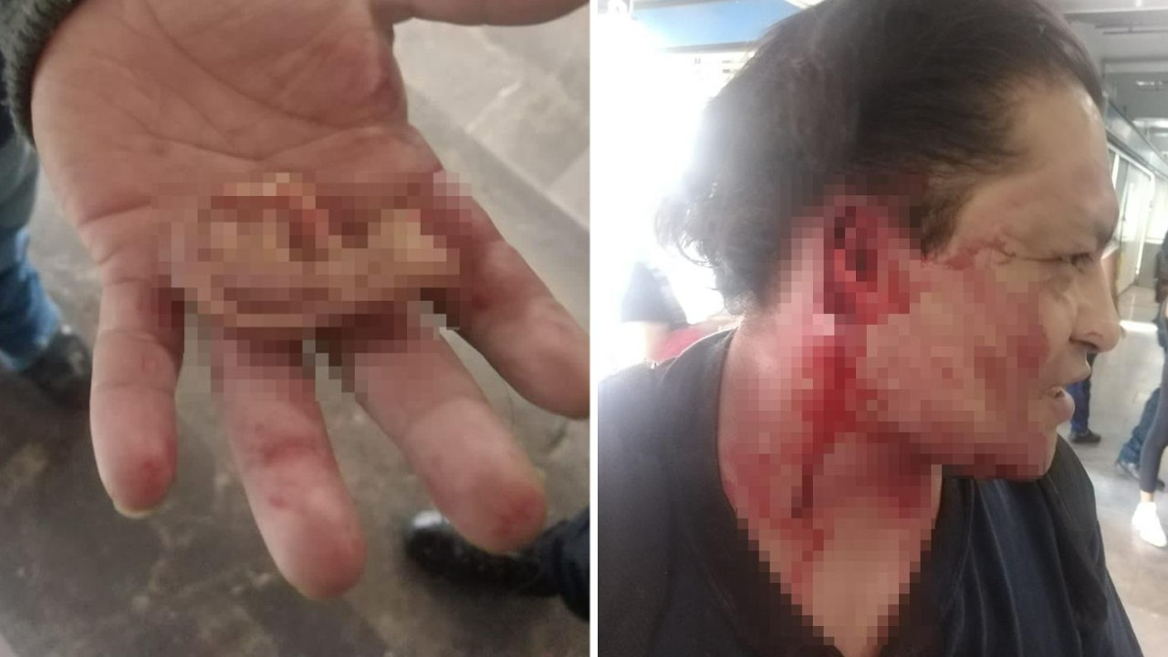 Meksika'da metroda taciz kavgası! Yolculardan biri tacizcinin kulağını koparttı