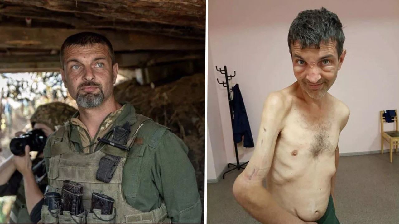 Takası Türkiye'de yapılan Ukraynalı askerin görüntüsü dehşete düşürdü! Hali içler acısı...