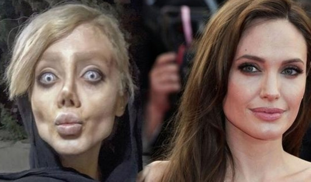 Angelina Jolie'ye benzemek için estetik oldum demişti!