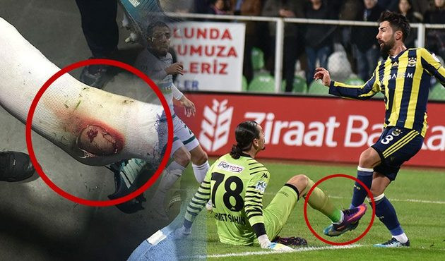 Hasan Ali Kaldırım'ın ayağının fotoğrafını paylaştılar!